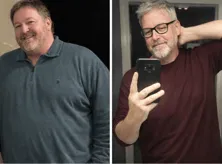 Michael H. Before and After