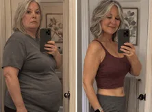 Sabine G. Before and After