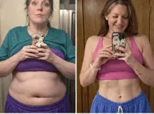 Nina F. Before and After