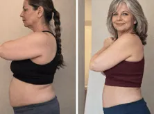 Sophie M. Before and After
